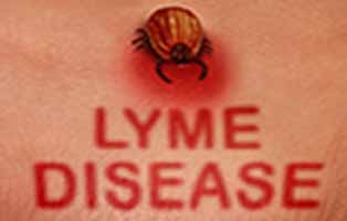 Long Island Tick Spraying